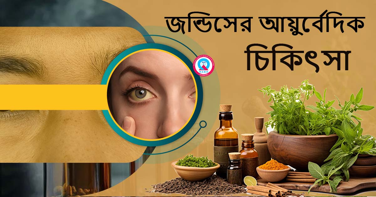 ayurvedic-treatment-for-jaundice
